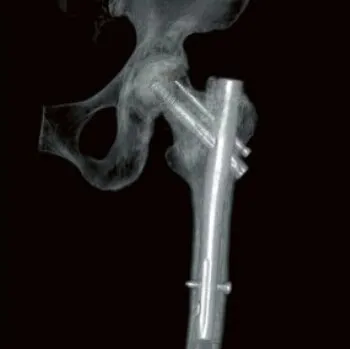 Клинические изображения Canon ASTELION 16 (32) Компьютерный томограф