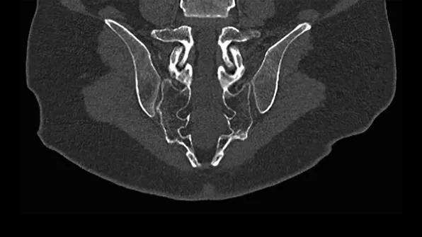 Клинические изображения Siemens SOMATOM go.Now компьютерный томограф