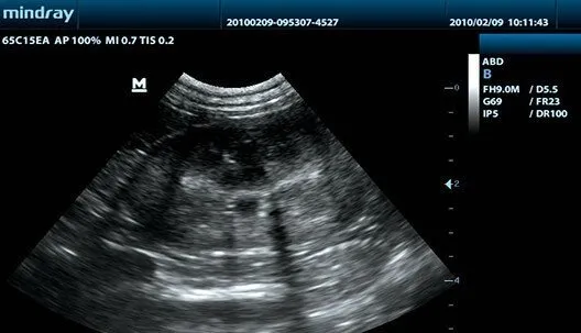 Клинические изображения УЗИ аппарат Mindray DP-30 Vet портативный ветеринарный
