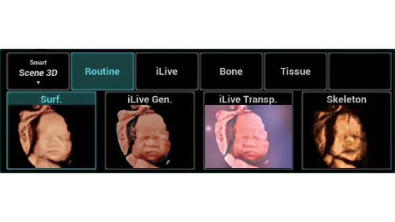 Клинические изображения УЗИ аппарат Mindray Imagyn I9