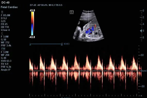 Клинические изображения УЗИ аппарат Mindray DC-45