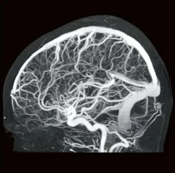 Клинические изображения Canon ASTELION 16 (32) Компьютерный томограф