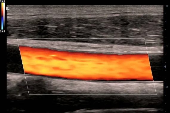 Клинические изображения УЗИ аппарат Mindray DC-45