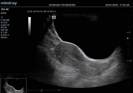Клинические изображения УЗИ аппарат Mindray DC-40 Exp