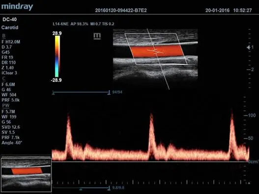 Клинические изображения УЗИ аппарат Mindray DC-40