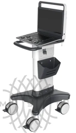 Sonoscape E3 ультразвуковой аппарат