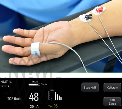 Mindray A8 наркозно-дыхательный аппарат 