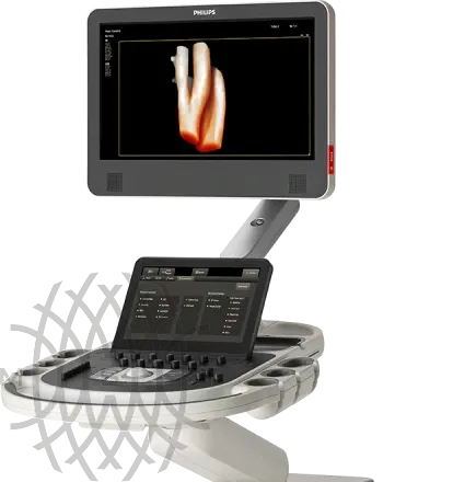 Philips EPIQ CVx ультразвуковой аппарат
