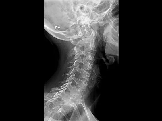 Клинические изображения GE Healthcare Optima XR220amx палатный цифровой рентгеновский аппарат