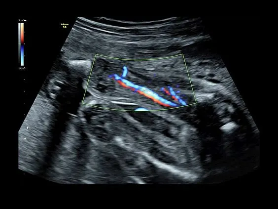 Клинические изображения GE Voluson S8 ультразвуковой аппарат