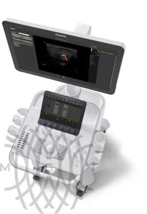 УЗИ аппарат Philips 3300