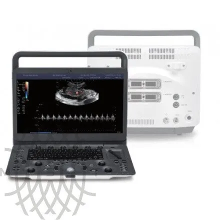 Sonoscape E2 ультразвуковой аппарат