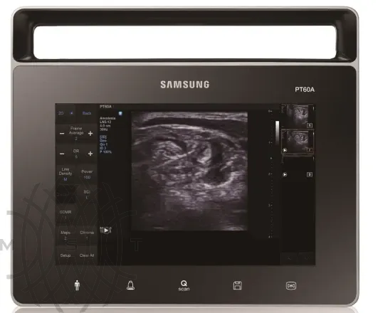 Samsung Medison PT60 УЗИ аппарат