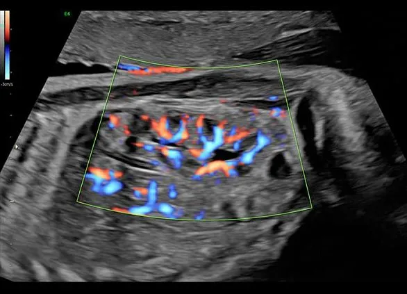 Клинические изображения Ультразвуковая диагностическая система GE HealthCare Voluson E6
