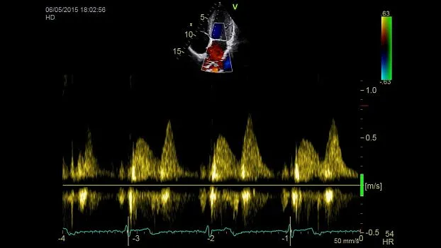 Клинические изображения Ультразвуковая диагностическая система GE HealthCare Vivid iQ портативная