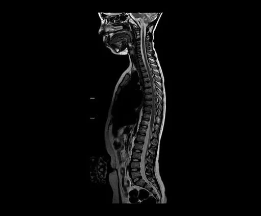 Клинические изображения МРТ аппарат GE SIGNA Architect 3T