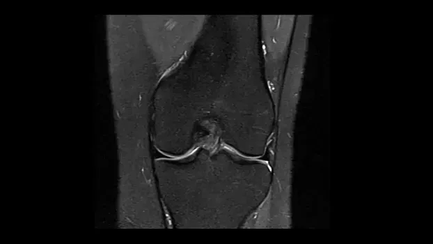 Клинические изображения Магнитно-резонансный томограф Siemens MAGNETOM Free.Max