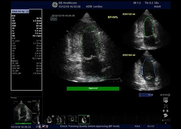Клинические изображения GE Logiq F8 аппарат УЗИ
