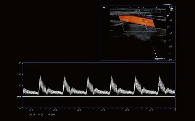 Клинические изображения Canon (Toshiba) Aplio i700 аппарат УЗИ