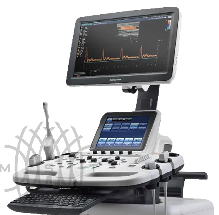 Sonoscape S30 ультразвуковой аппарат