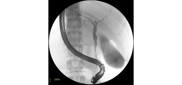 Клинические изображения Philips BV Pulsera С-дуга