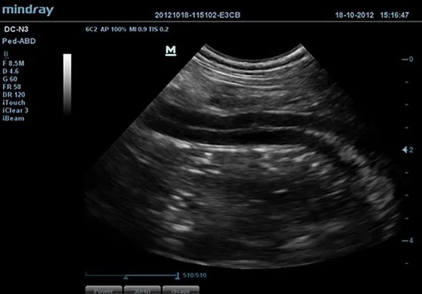 Клинические изображения УЗИ аппарат Mindray DC-N3 Vet портативный ветеринарный 