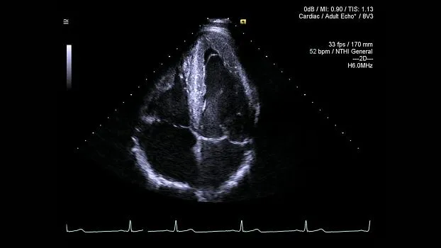 Клинические изображения Siemens Acuson SC2000 ультразвуковая система