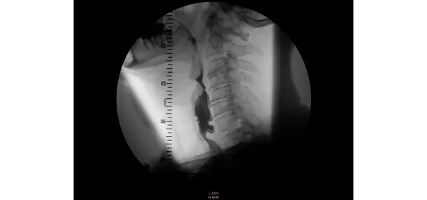 Клинические изображения Philips BV Pulsera С-дуга