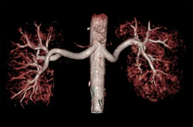 Клинические изображения МРТ аппарат GE SIGNA Creator 1.5T