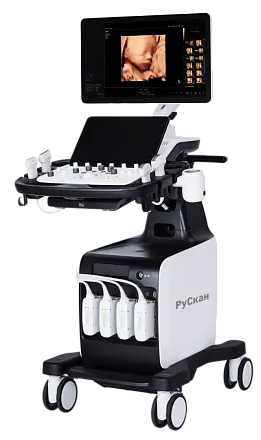 УЗИ аппарат РуСкан 80