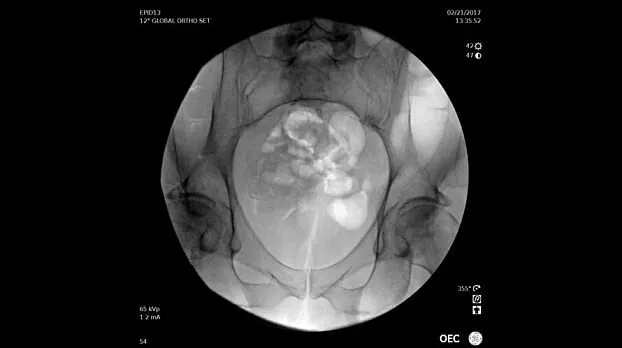 Клинические изображения Рентгенохирургический аппарат типа С-дуга GE OEC Elite II