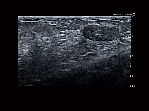 Клинические изображения Canon (Toshiba) Aplio a450 аппарат УЗИ