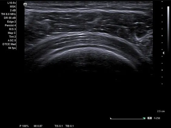 Клинические изображения Siemens Acuson NX2 аппарат УЗИ