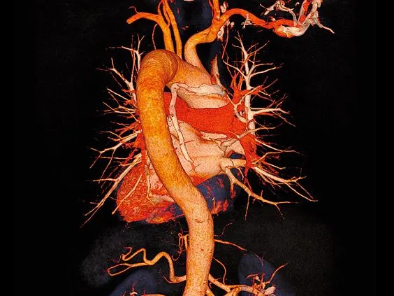 Клинические изображения Siemens SOMATOM go.Up компьютерный томограф