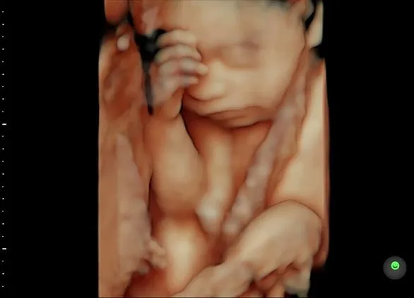 Клинические изображения Ультразвуковая диагностическая система GE HealthCare Voluson E6