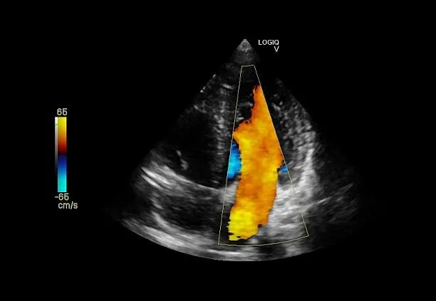 Клинические изображения УЗИ аппарат GE HealthCare Vscan Air карманный