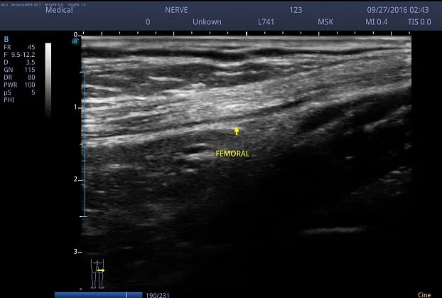 Клинические изображения Ультразвуковой аппарат Sonoscape S2N