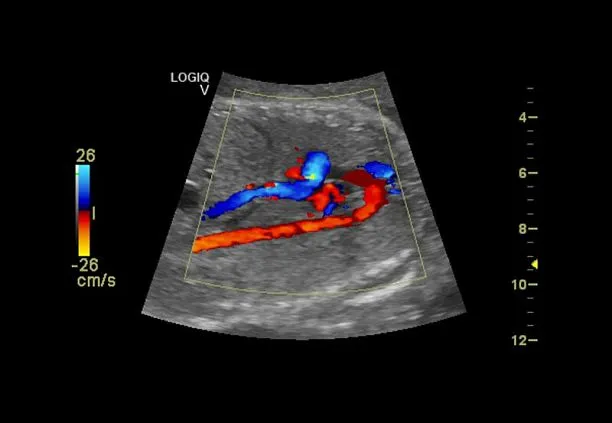 Клинические изображения УЗИ аппарат GE HealthCare Vscan Air карманный