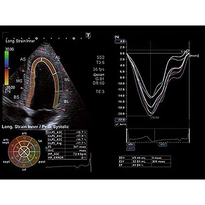 Клинические изображения Canon (Toshiba) Xario 200G аппарат УЗИ