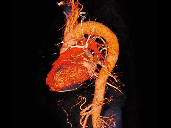 Клинические изображения Siemens SOMATOM go.Now компьютерный томограф