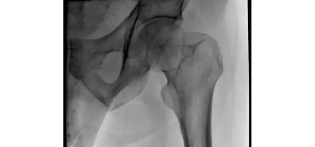 Клинические изображения С-дуга Philips Zenition 30