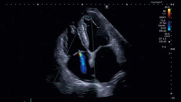 Клинические изображения Canon (Toshiba) Aplio i900 аппарат УЗИ