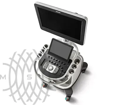 Philips Affiniti 70 ультразвуковой аппарат