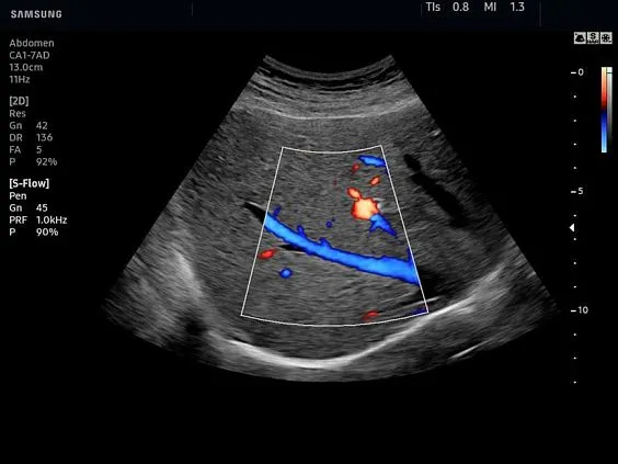 Клинические изображения Samsung Medison HS50 УЗИ аппарат