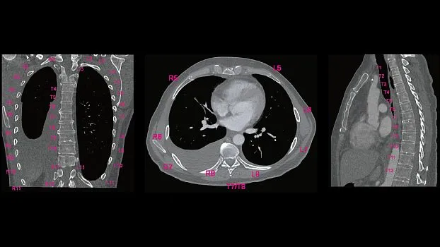 Клинические изображения Siemens SOMATOM go.Up компьютерный томограф