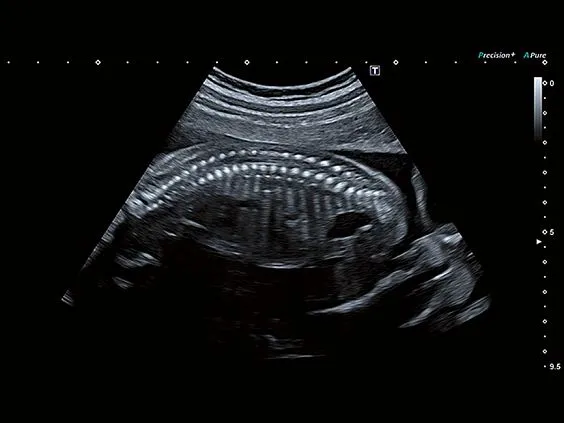 Клинические изображения Canon (Toshiba) Aplio a450 аппарат УЗИ