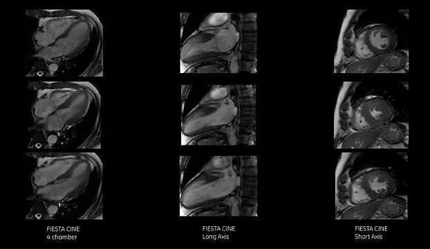 Клинические изображения УЗИ аппарат GE HealthCare Logiq F6