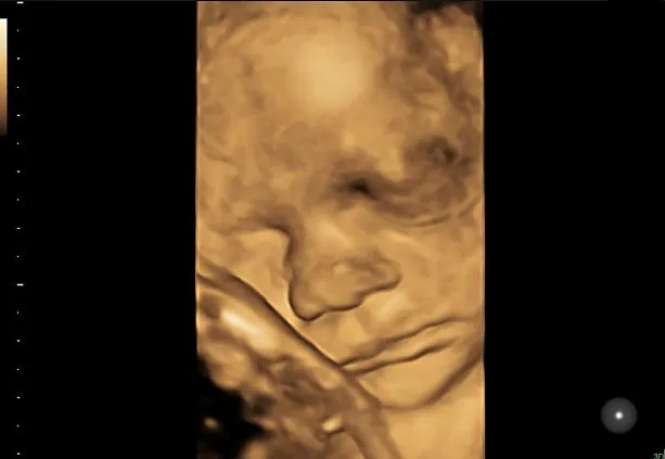 Клинические изображения УЗИ аппарат GE HealthCare Voluson S10