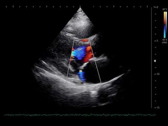 Клинические изображения УЗИ аппарат НПО СКАНЕР РУСКАН 60