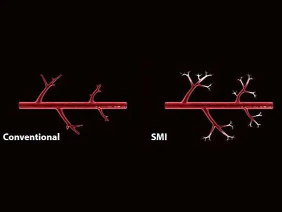 Клинические изображения Canon (Toshiba) Aplio a550 аппарат УЗИ